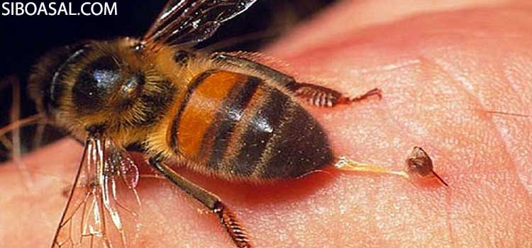 کاهش علائم آرتروز در مقاله خواص زهر زنبور عسل