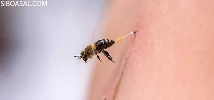 درمان آلرژی در مقاله خواص زهر زنبور عسل